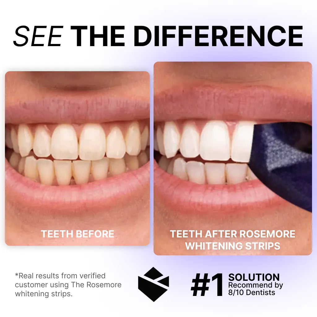 Purple Teeth Whitening Strips