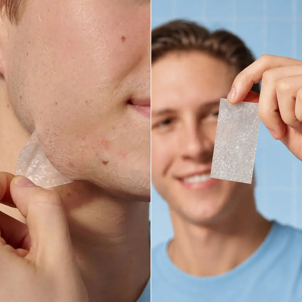 Rosemore Clear Skin Hydrocolloid Roll